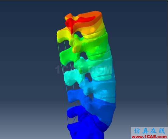 【醫(yī)學應用】骨科知識和有限元分析ansys圖片3